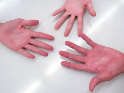 3人の手のひらの写真